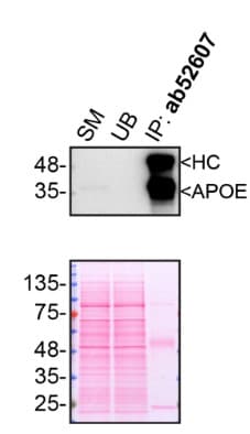 Anti-Apolipoprotein E antibody [EP1374Y](AB52607)