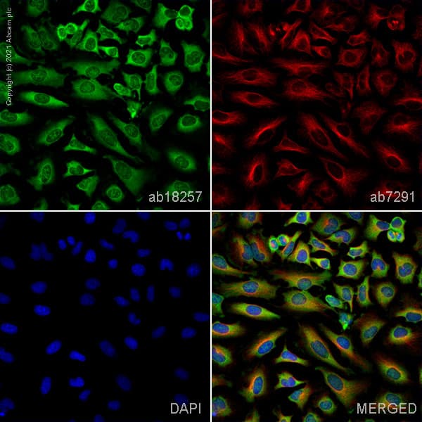 Park7 Dj1 Antibody Ab18257  Immunocytochemistry Immunofluorescence Img176582