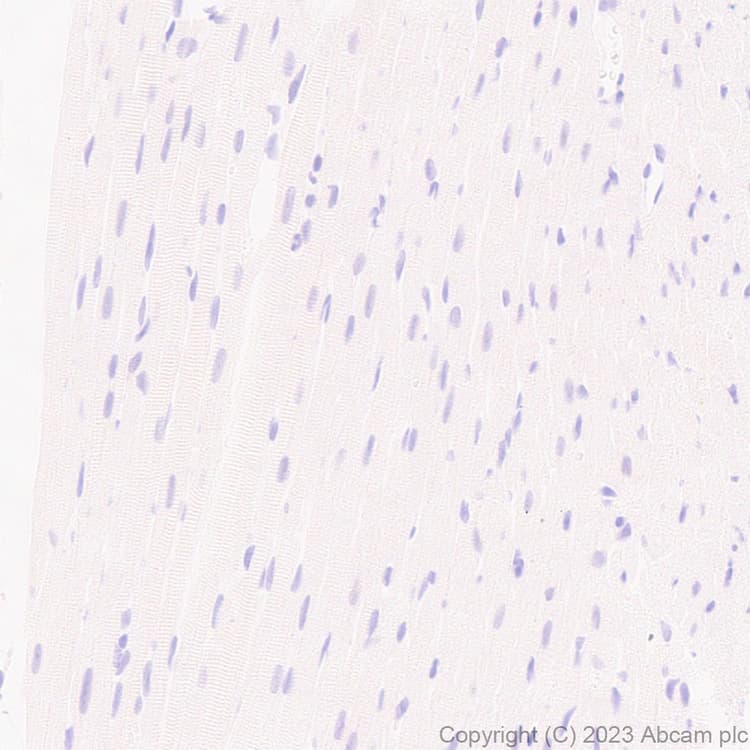 Anti-MATH2/NEUROD6 antibody [EPR28660-23](AB315812)