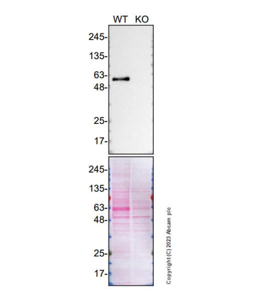 Smoc1 Antibody Epr26922 31 Ab313571  Western Blot Img418207