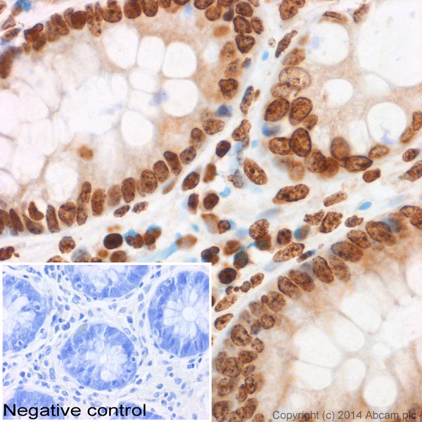 Histone H3 Tri Methyl K9 Antibody Chip Grade Ab8898 Immunohistochemistry Formalin Pfa Fixed Paraffin Embedded Se G3LMyE9E52