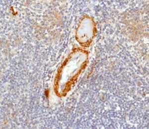 Anti-Calponin 1 antibody [EP798Y](AB46794)