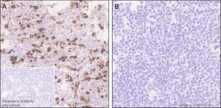 Anti-Adenovirus Type 5 Hexon antibody [EPR28237-57](AB316852)