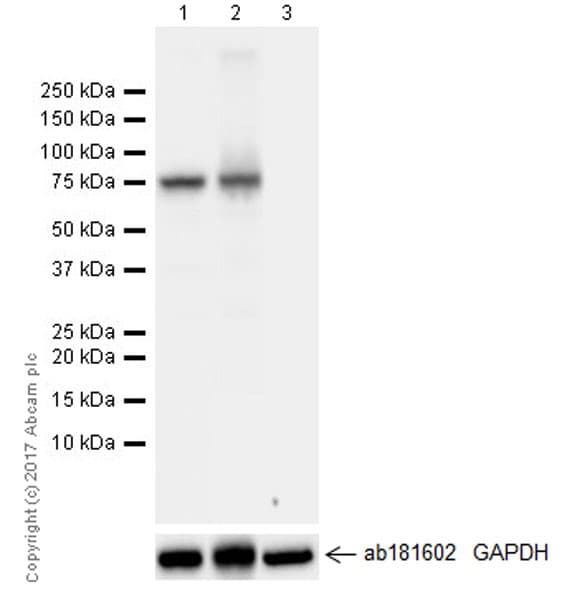 Anti-BTK antibody [EPR20445](AB208937)