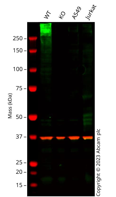 Anti-Glucose Transporter GLUT1 antibody [SP168](AB150299)