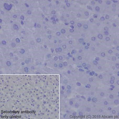 Anti-MMP7 antibody [EPR17888-101](AB205525)