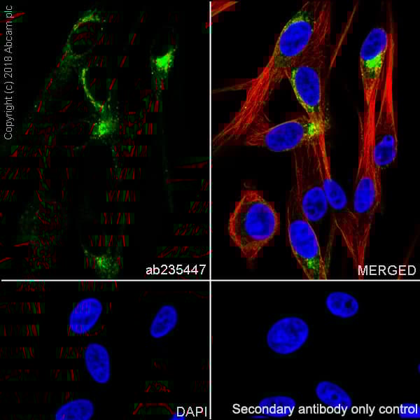 Anti-TRP1 antibody [EPR21960](AB235447)