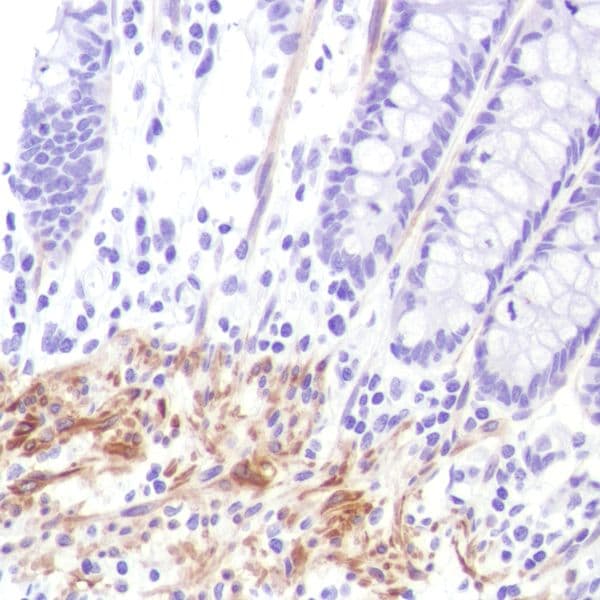 Anti-Calponin 1 antibody [SP180] - C-terminal(AB227660)