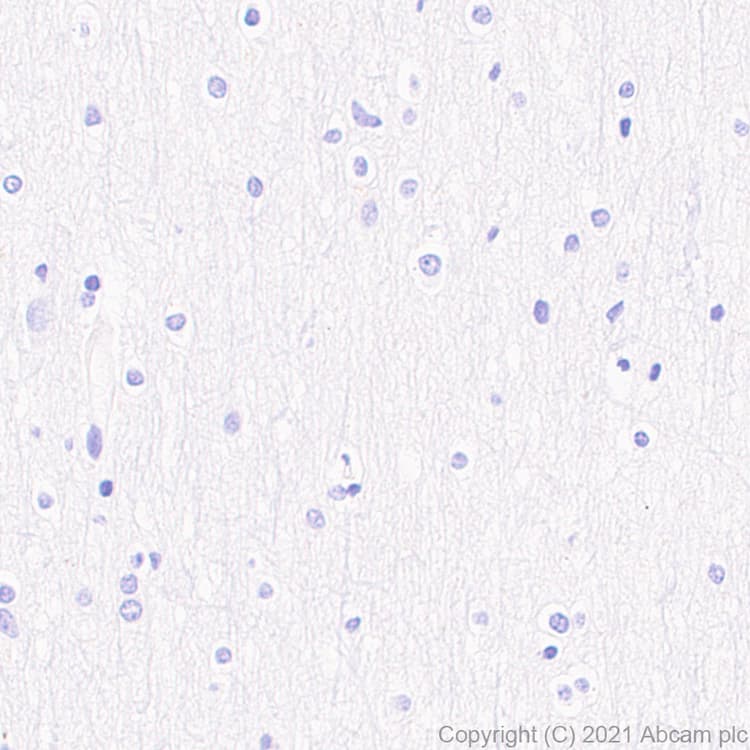 Cd127 Antibody Epr23747 333 Ab259806  Immunohistochemistry Formalin Pfa Fixed Paraffin Embedded Sections Img174448