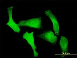 Ipo5 Antibody Ab88695  Immunocytochemistry Immunofluorescence Img113478