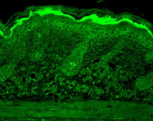 Anti-Calnexin - ER membrane marker antibody - ER Marker(AB13504)