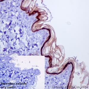 Loricrin Antibody Epr71492 C Terminal Ab198994  Immunohistochemistry Formalin Pfa Fixed Paraffin Embedded Sections Img117491
