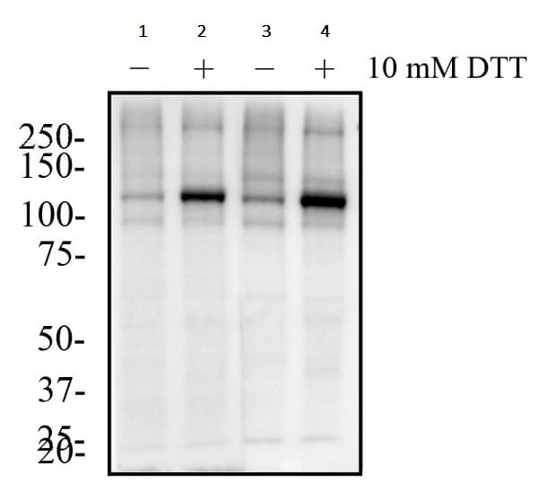 Anti-IRE1 (phospho S724) antibody(AB48187)