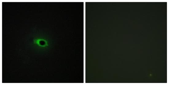 Col12a1 Antibody Ab196619  Immunocytochemistry Immunofluorescence Img70819