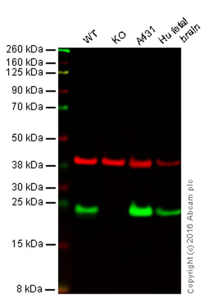 Anti-RAB7 antibody [EPR7589](AB137029)