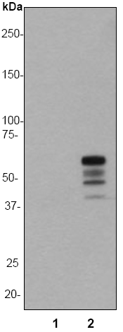 Vimentin Phospho S82 Antibody Ep1071y Bsa And Azide Free Ab284697  Western Blot Img29545