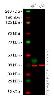 Anti-Synaptophysin antibody [YE269](ab32127)