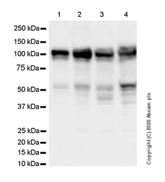 Anti-YTHDC1 antibody [EPR21821-213](AB259990)