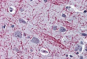 Anti-Mu Opioid Receptor antibody - N-terminal(AB140911)