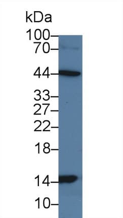 Anti-H-FabP antibody(ab231568)