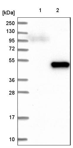 Anti-DHPS/DHS antibody(AB224134)