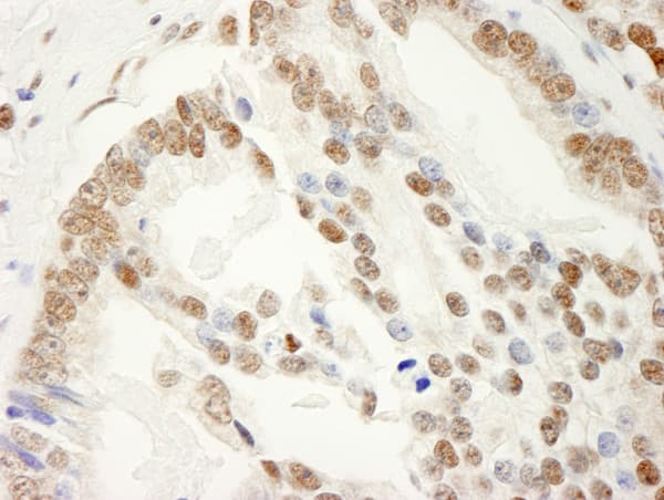 Sam68 Antibody Ab86239  Immunohistochemistry Formalin Pfa Fixed Paraffin Embedded Sections Img108885