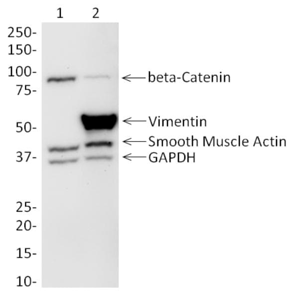 Epithelial-Mesenchymal Transition (Beta Catenin, Vimentin) Western Blot Cocktail(AB157392)