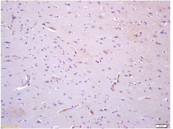 Anti-TIE1 antibody(AB203078)
