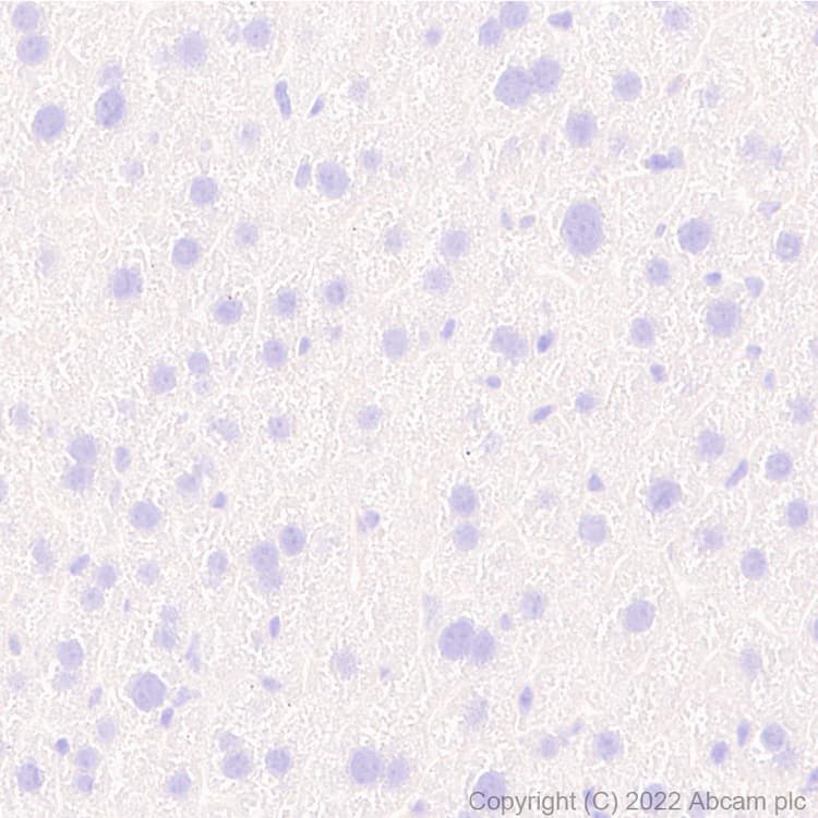 Anti-Bassoon/BSN antibody [L124-59](AB306593)