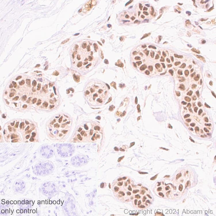 Tls Fus Antibody Epr5812 Ab124923  Immunohistochemistry Formalin Pfa Fixed Paraffin Embedded Sections Img170904