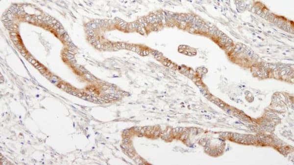 Map7 Antibody Ab240695  Immunohistochemistry Formalin Pfa Fixed Paraffin Embedded Sections Img120534