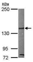 Sin3b Antibody Ab101841  Western Blot Img98899