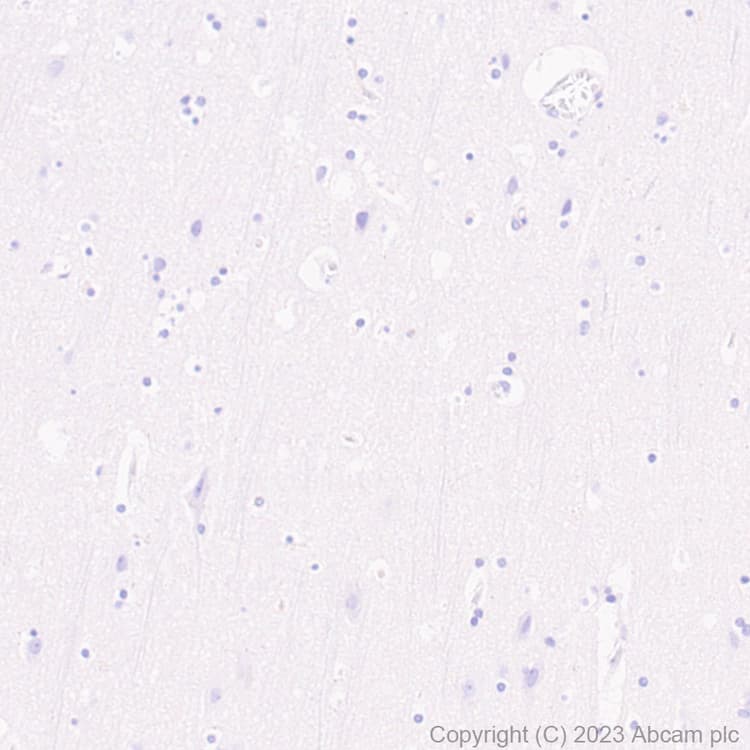 Cd96 Antibody Epr26489 23 Bsa And Azide Free Ab315219  Immunohistochemistry Formalin Pfa Fixed Paraffin Embedded Sections Img424260