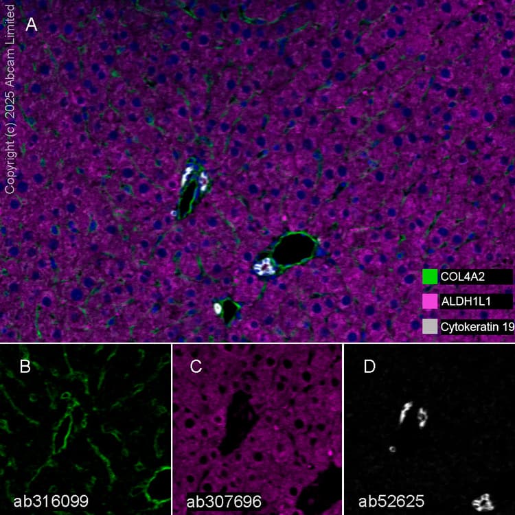 Aldh1l1 Antibody Epr25443 103 Astrocyte Marker Ab307696  Multiplex Immunohistochemistry Img447126