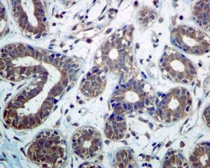 Dctn3 Antibody Epr5097 Ab124674  Immunohistochemistry Formalin Pfa Fixed Paraffin Embedded Sections Img87781