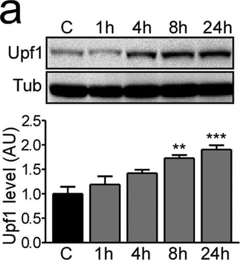 Anti-RENT1/hUPF1 antibody [EPR4681](AB109363)