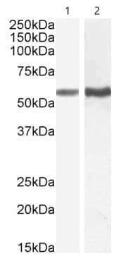 Tgf Beta Receptor I Antibody Ab121024  Western Blot Img97219