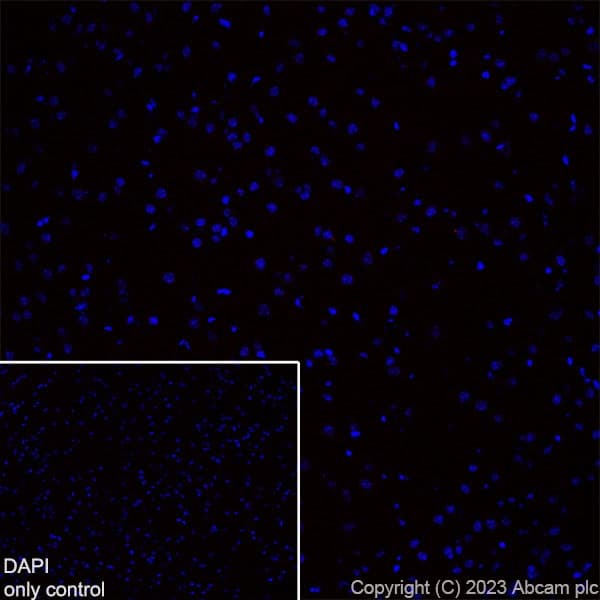 Alexa Fluor® 555 Anti-CD4 antibody [EPR19514](AB313727)