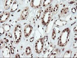 Samhd1 Antibody Oti1a1 Ab128107  Immunohistochemistry Formalin Pfa Fixed Paraffin Embedded Sections Img58917