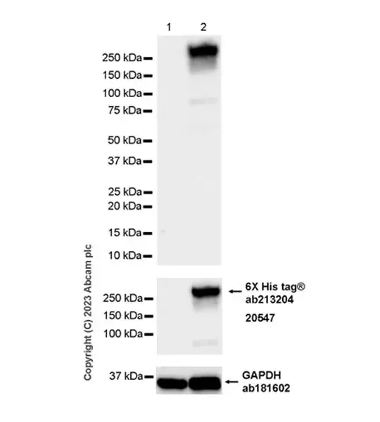 Anti-Streptococcus mutans Cell surface antigen I/II antibody [EPR28235-11](AB316006)