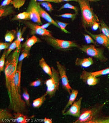 Anti-Huntingtin antibody [EP867Y](AB45169)