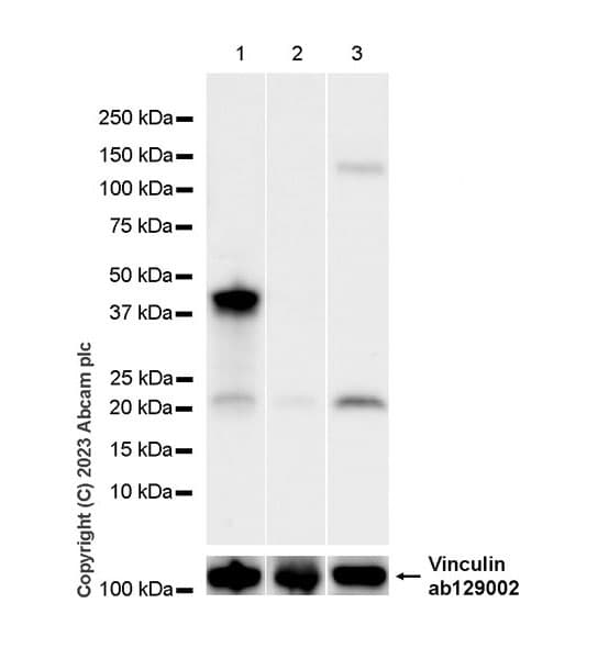 Anti-FOXF1 antibody [EPR27368-79](AB308633)