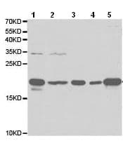Anti-Ferritin Light Chain antibody(AB186871)