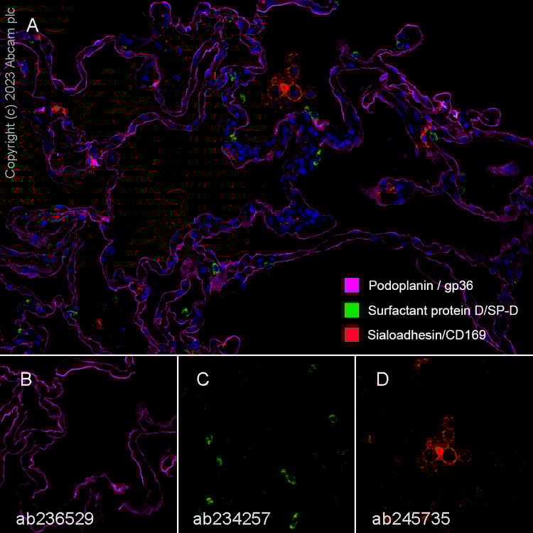 Anti-Surfactant protein D/SP-D antibody [EPR21928-209] - BSA and Azide free(AB234257)