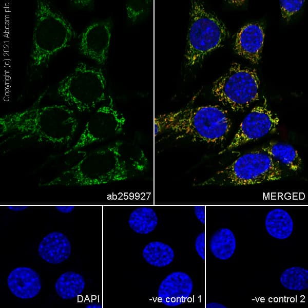 Anti-LRPPRC/GP130 antibody [EPR24052-38](AB259927)