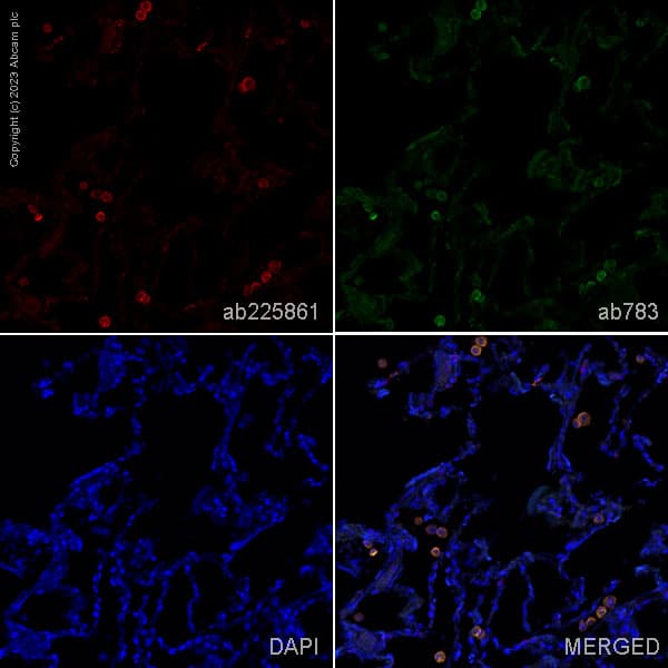 Anti-TREM1 antibody [EPR22060-229](AB225861)