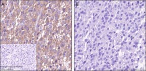 Anti-PKC alpha (phospho T497) antibody [EP2608Y] - BSA and Azide free(AB284734)