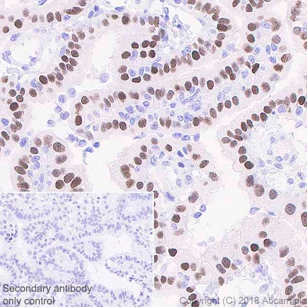 Anti-FoxJ1 antibody [EPR21874](AB235445)
