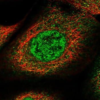 Asef2 Antibody Ab122701  Immunocytochemistry Immunofluorescence Img68738