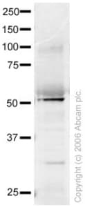 Anti-FOXA1 antibody(AB23738)